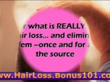 hair loss at a young age - hair loss home remedies - hair