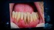 Cosmetic Dentists Fairfax Va|Dental Check-up