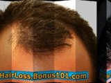 regrow hair naturally for men - regrow hair menopause