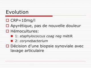 Une arthrite pas banale