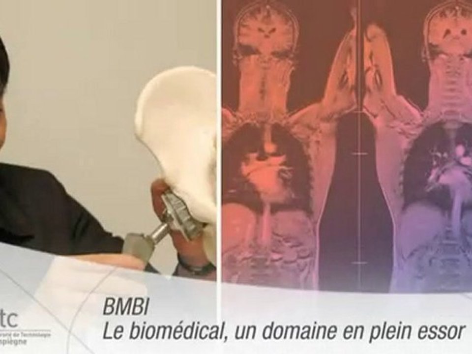 Unité de recherche UTC - BMBI