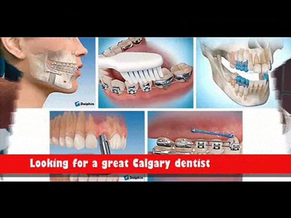 Calgary Dentist