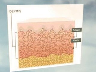 Eczema Rashes, Signs and Symptoms