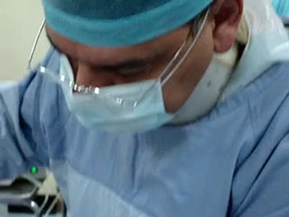 laser liposuction-شفط الدهون بالليزر