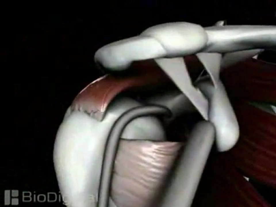 Medical