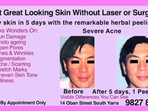 Beauty Salons South Yarra An Image Renaissance VIC