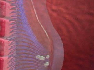 Mucoviscidose : Symptômes, Définition, Diagnostic, Traitemen