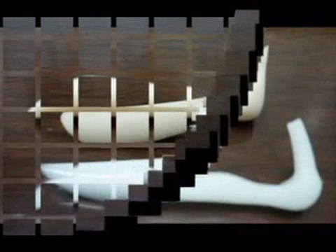 Phẫu Thuật Thẩm Mỹ Mũi Thẩm Mỹ Viện ThS.BS Phan Quốc Vinh