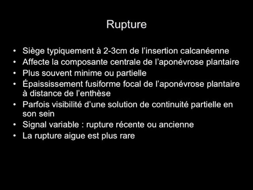 Atteinte de l’aponévrose plantaire : 3 cas cliniques