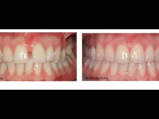 Apparecchio Invisibile