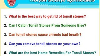 Can you still have tonsil stones after Laser tonsillectomy?