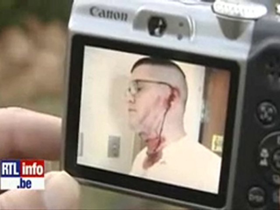 téléphone explose au visage