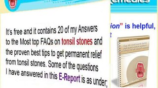 Do Tonsil Stones cause throat infections?
