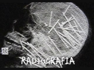 Radiografia Rock Radio - 6° Puntata