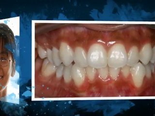 Houston orthodontists - Dr. Schimek