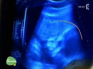 Générique 'RDV à la maternité' (France 5)