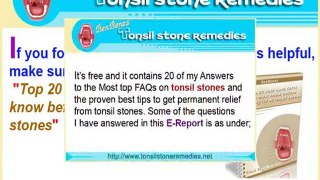 What antibiotics do I need to take for tonsil stones?