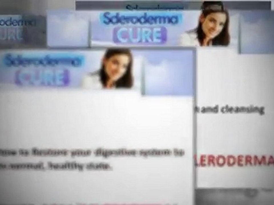 Scleroderma Cure | Treatments For Scleroderma