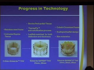 A.Vahanian - 2ème Partie