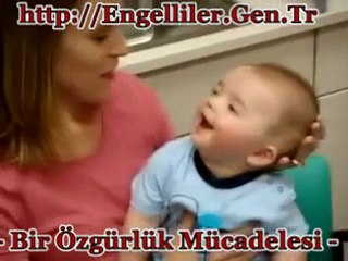 Bebeğin Annesinin Sesini Duyduğu İlk An Engelliler.Gen.Tr