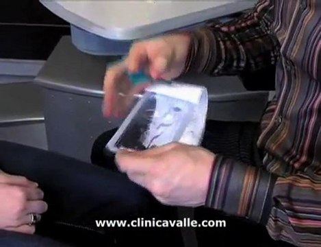 Tapones Lagrimales. Tratamiento del Ojo Seco