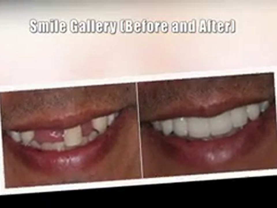 Carmichael Cosmetic Dentist Dr. Elizabeth Huynh, DDS