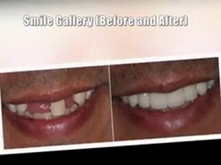 Carmichael Cosmetic Dentist Dr. Elizabeth Huynh, DDS