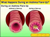 Asthma facts :What happen in breathing in Asthma Patient