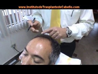 Ecuador Hair Graft Institute, Cuenca - Dr ARIZAGA