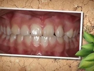 Orthodontist Houston - Dr. Schimek