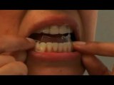 Teeth Whitening - How to use Teeth Whitening Strips