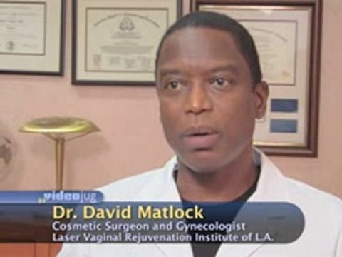 Labiaplasty : Do large labias restrict physical movement?