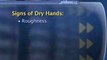 How To Prevent Dry Skin On Your Hands : How can I prevent dry skin on my hands?