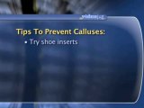 How To Prevent Calluses : How can I prevent calluses?