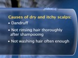 Itchy Scalp : What can be the causes of dry and itchy scalps?
