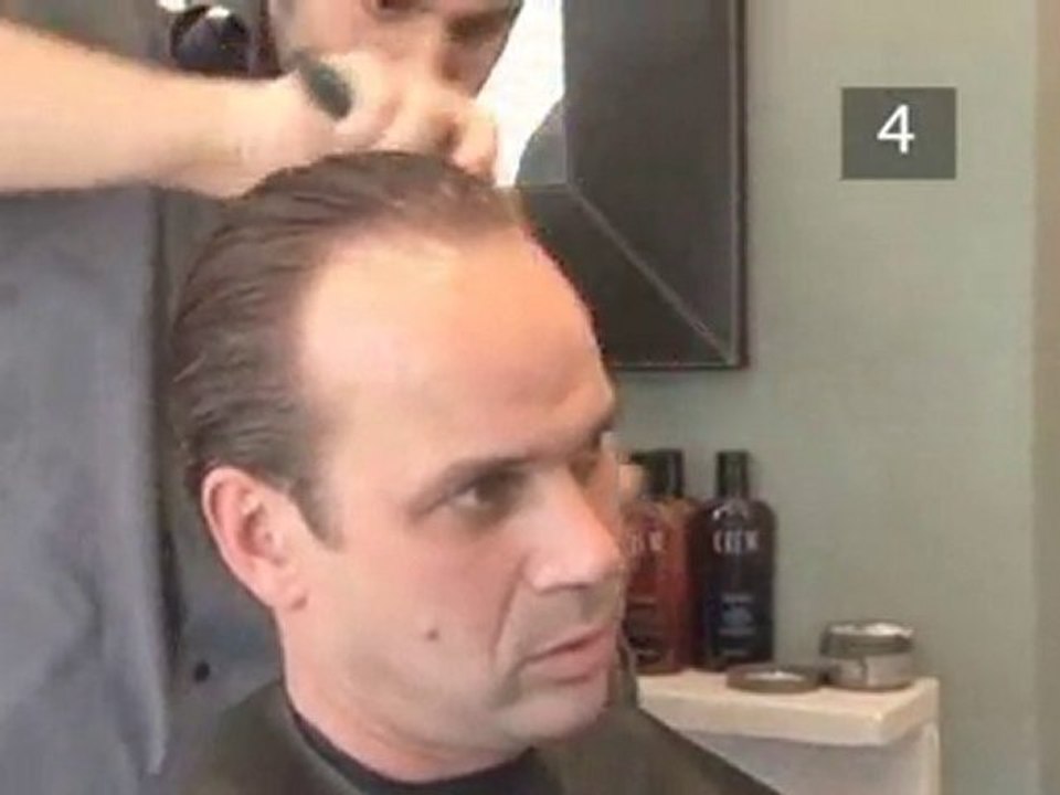 How To Cope With A Receding Hairline