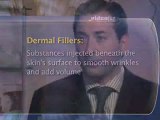 Dermal Fillers : What are 