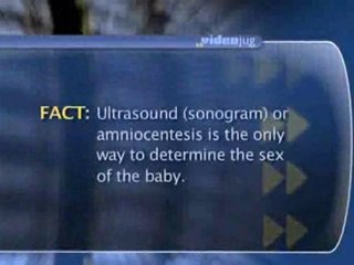 Myths About Pregnancy : Can I figure out if I'm having a boy or a girl by the shape of my belly?