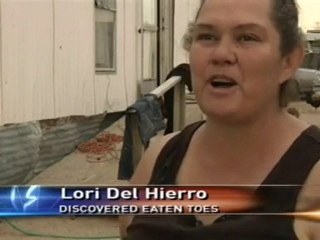 Rats Bite Off Woman's Toes