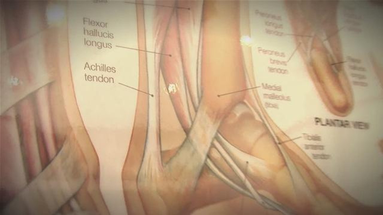 How To Cure Plantar Fasciitis