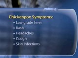 Chickenpox Symptoms : What are the symptoms of chickenpox?
