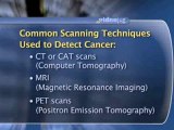 Cancer Detection : What scanning techniques are used to detect cancer?