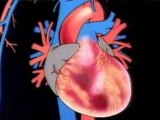 Aging And Disease : What are the warning signs of a heart attack?