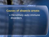 Alopecia Areata : What causes alopecia areata?