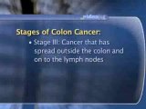 Colorectal Cancer Treatment : How is colon cancer treated?