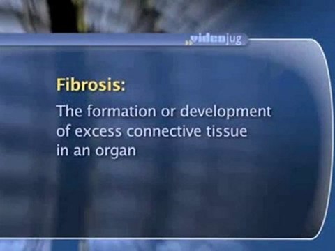 Colorectal Cancer: What To Expect After : What sexual problems are associated with colorectal cancer treatment?