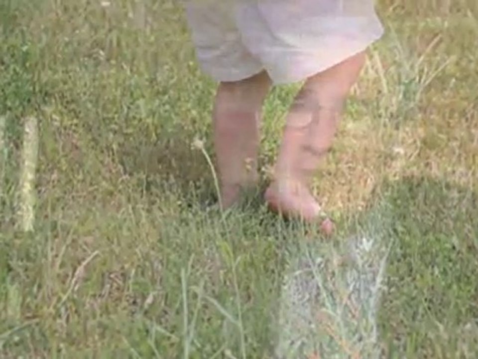 Allergy Basics : What are "skin allergies"?