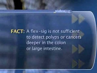 Colorectal Cancer Detection : What is a "flexible sigmoidoscopy" or "flex-sig"?