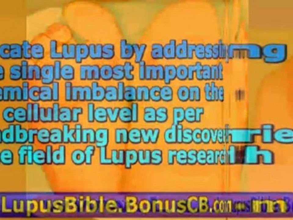 lupus headache - lupus and hair loss - lupus treatment guide