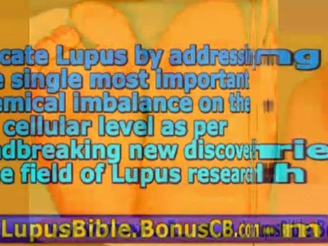 lupus headache - lupus and hair loss - lupus treatment guide